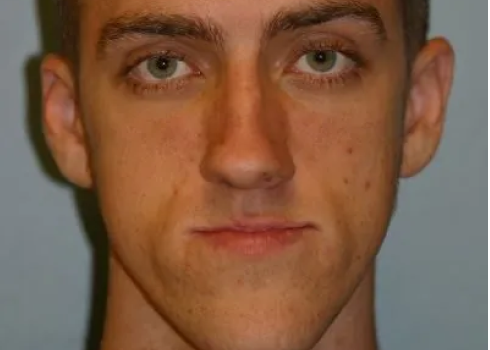 Case joe before query